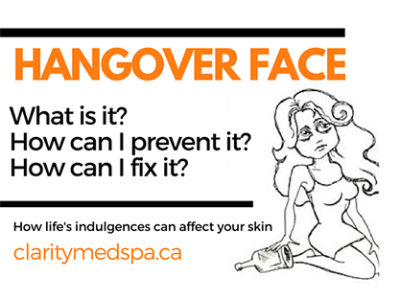 Helpful Tips to Improve Hangover Face!