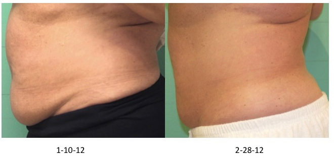 results after treatment