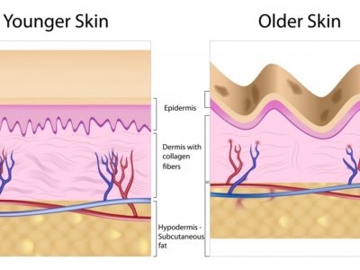 younger skin