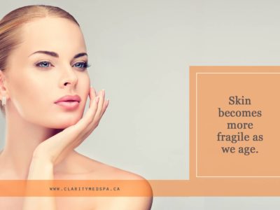 How Aging Affects Skin