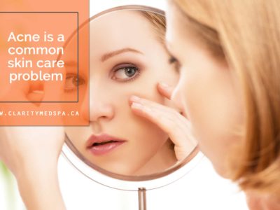 Acne is a common skin care problem