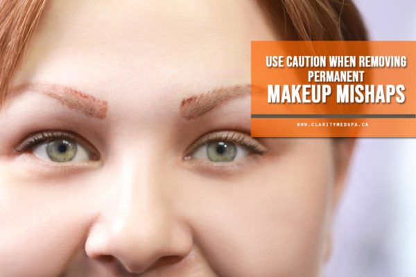 Use caution when removing permanent makeup mishaps
