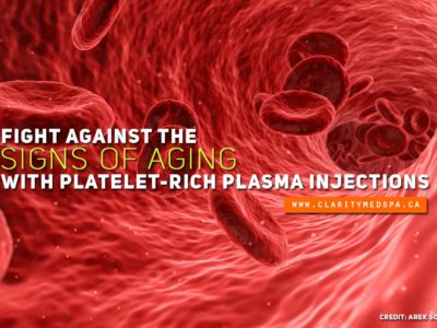 Fight against the signs of aging with platelet rich plasma injections