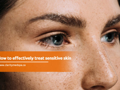 treat sensitive skin