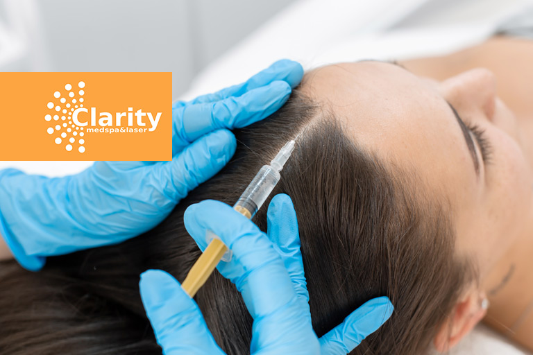 Do You Need PRP Treatment for Hair Loss? - Clarity MedSpa