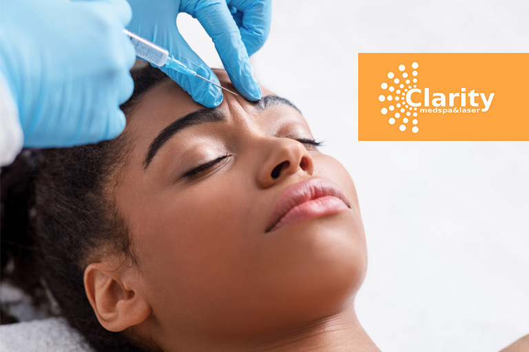 Botox brow lift is a non-invasive procedure that reduces fine lines and wrinkles